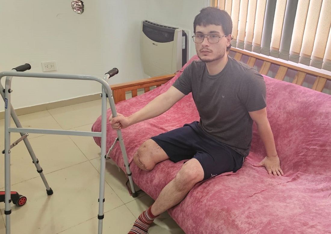 (VIDEO) Iba en moto, lo chocaron y le amputaron una pierna: “Estuve muy cerca de la muerte”